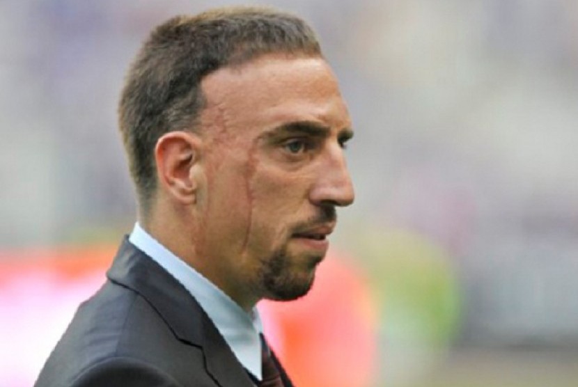 Franck Ribery