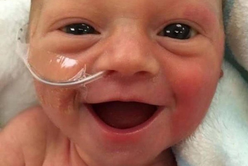 Freya, bayi prematur yang memperlihatkan senyum lebarnya