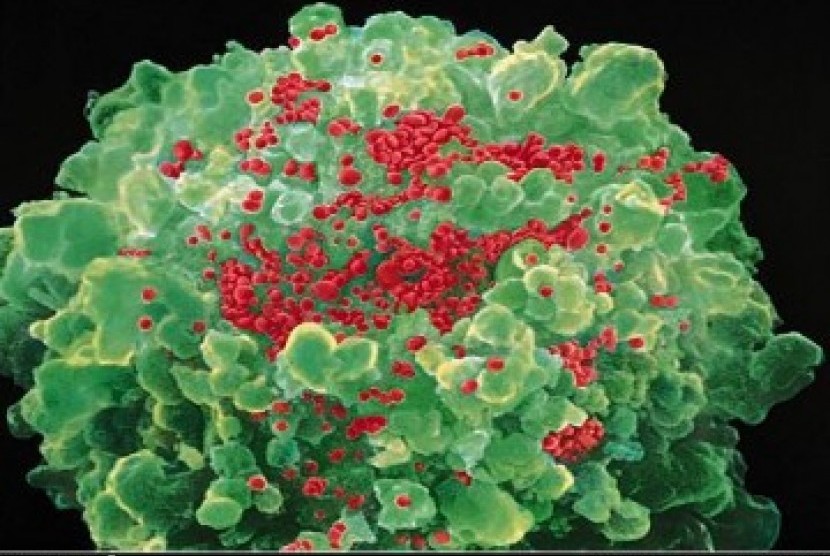 Gambar bagaimana virus AIDS menghancurkan sistem kekebalan tubuh, ilustrasi