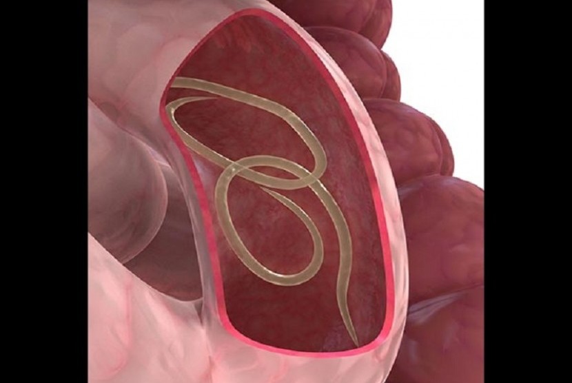 Gambar ilustrasi parasit dalam usus