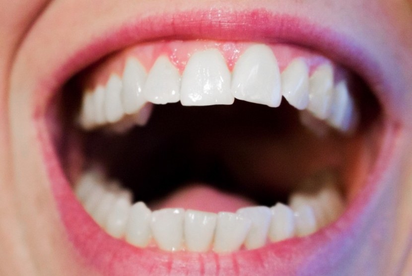 Gigi cerah. Ada banyak cara mendapatkan gigi dengan warna cerah, salah satunya dengan teknik manikur gigi.