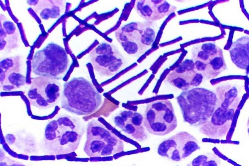 Gram stain anthrax (illustration)