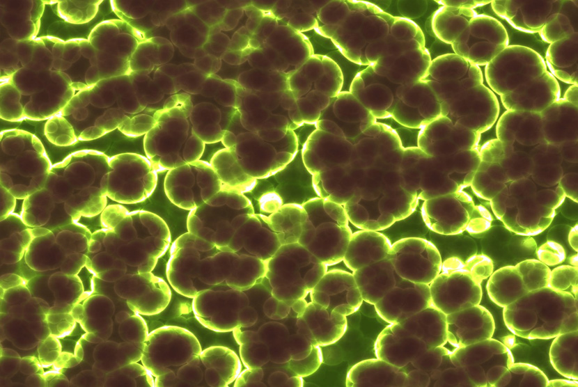 Bakteri. Remaja di AS mengungkapkan pengalaman mengerikan saat terinfeksi amoeba pemakan otak. (ilustrasi)