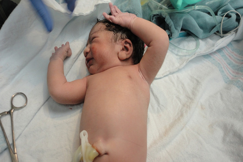 Ilustrasi Bayi baru lahir. Kementerian Kesehatan RI mewajibkan seluruh bayi baru lahir di Indonesia menjalani Skrining Hipotiroid Kongenital (SHK) untuk mendeteksi sejak dini potensi kekurangan hormon tiroid yang dapat memicu gangguan metabolisme.