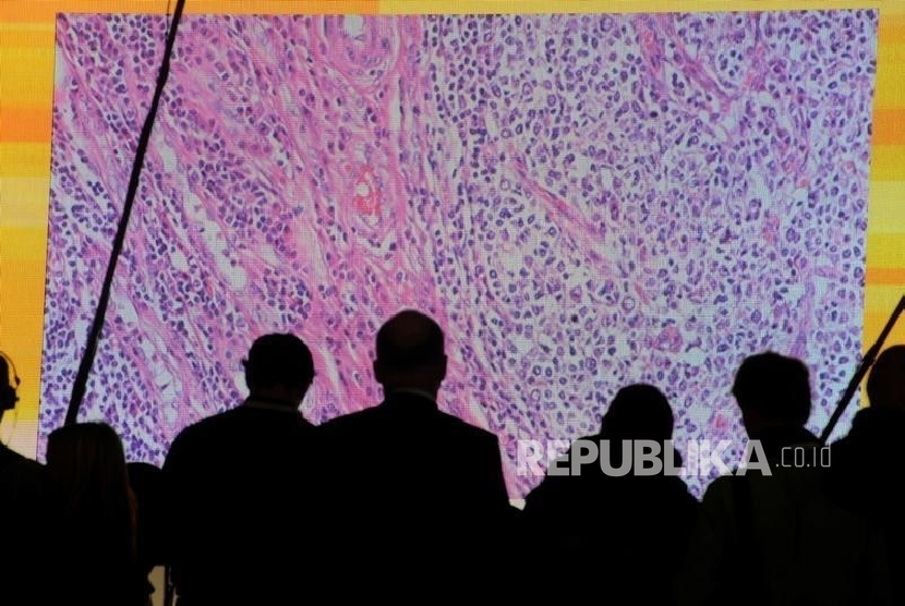 Ilustrasi Sel-sel kanker yang terlihat di layar besar.