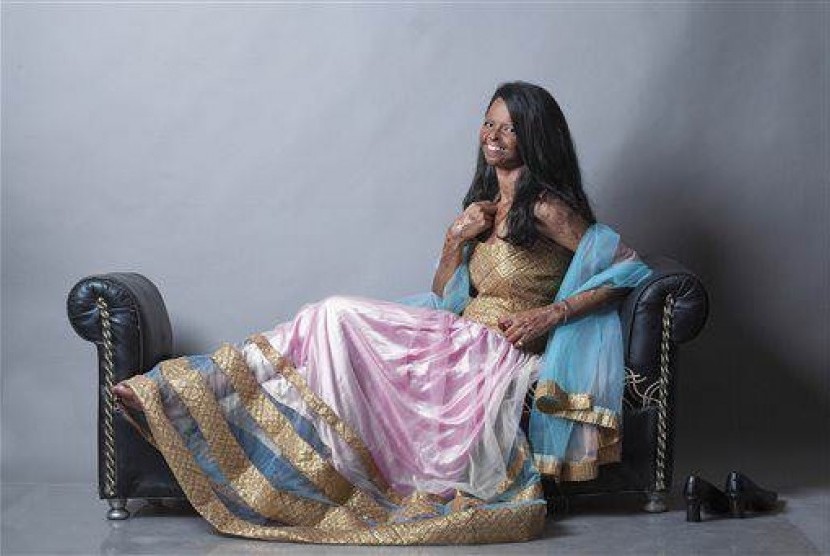 In this Aug. 4, 2014 photo provided by Rahul Saharan, Indian acid attack victim Laxmi, 22, poses during a fashion photo shoot in New Delhi, India. 