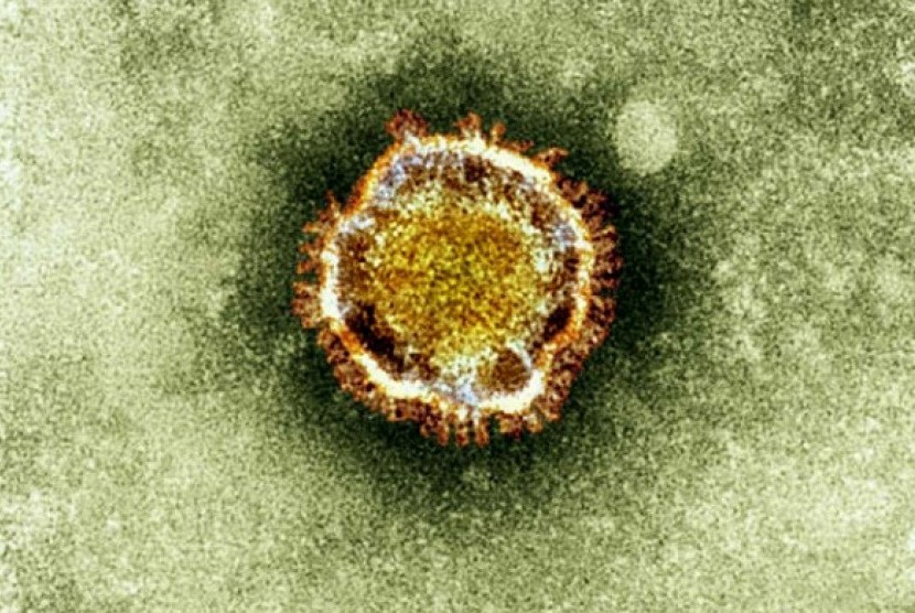 MERS Coronavirus dilihat di bawah mikroskop elektron (ilustrasi)