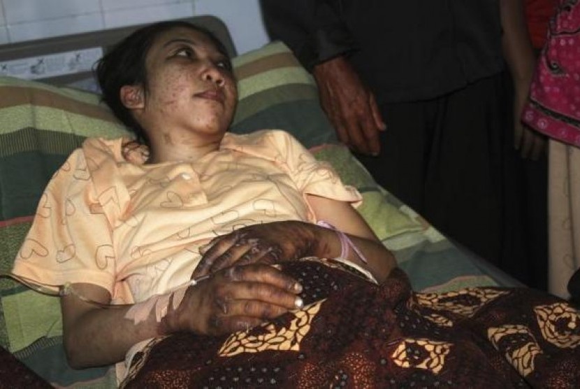 Indonesian domestic helper Erwiana Sulistyaningsih lies in a bed whilst being treated at a hospital in Sragen, Indonesia's Central Java province January 17, 2014.