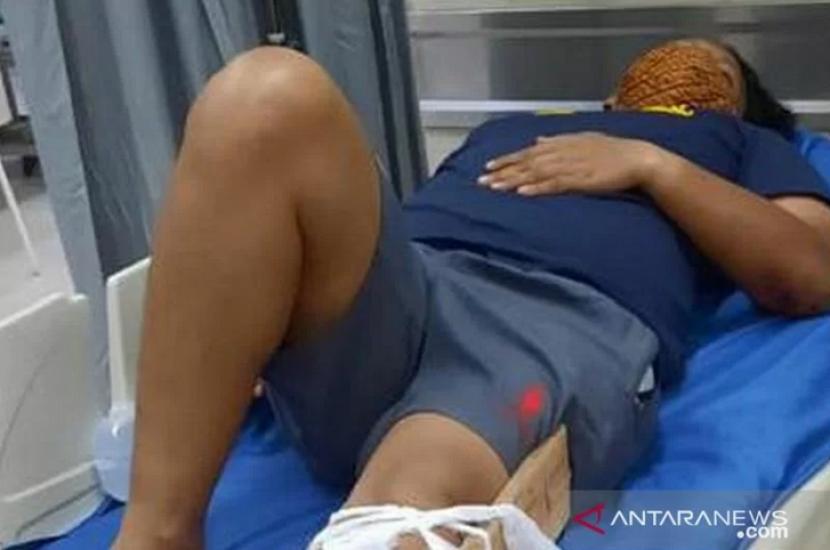 Iptu JM, polisi yang menjadi korban ditabrak bandar narkoba di Cirebon mengalami patah tulang di bagian kaki.