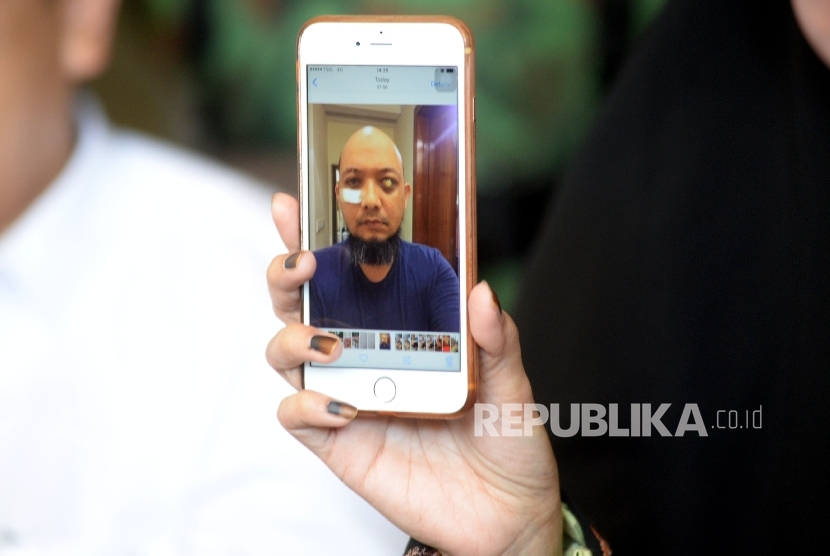  Novel Baswedan's wife, Rina Emilda, showed KPK senior investigator's latest photo when giving press information at his residence, Jakarta, Monday (August 28).