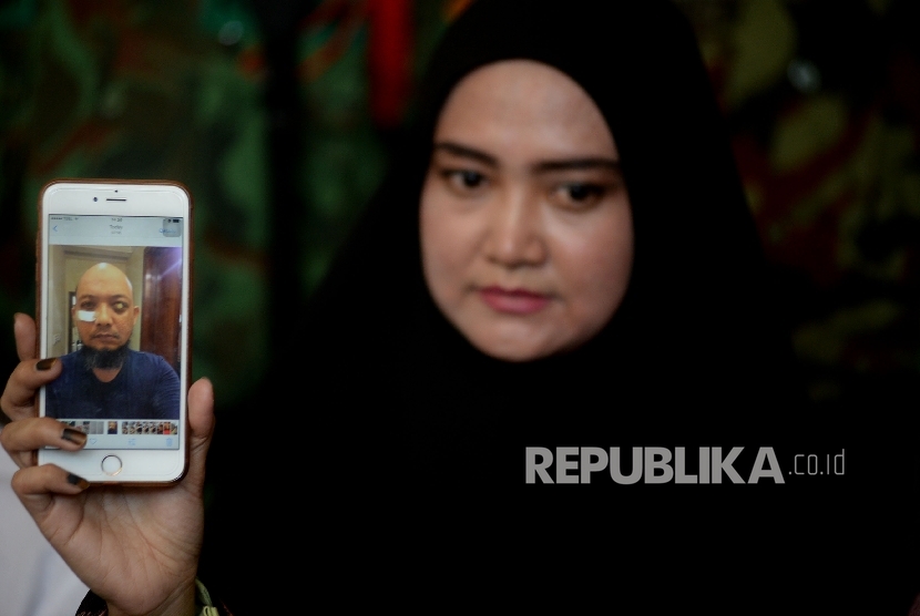 Istri penyiidik KPK Novel Baswedan, Rina Emilda menunjukan foto terbaru Novel saat memberikan keterangan pers di kediamannya, Jakarta, Senin (28/8). 