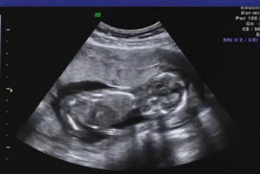 Janin dalam rahim(youtube)