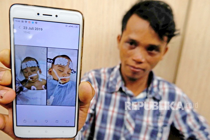 Juliadi Silitonga memperlihatkan foto bayi kembarnya yang telah selesai menjalani operasi pemisahan di RSUP H Adam Malik Medan, Sumatera Utara, Selasa (23/7/2019). 