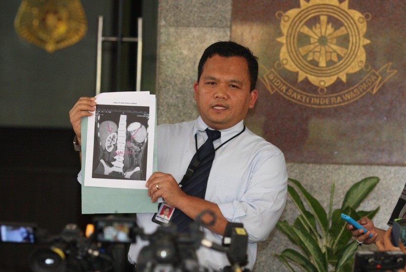 Kasubdit III Direktorat Tindak Pidana Umum Bareskrim Polri, Kombes Umar Surya Fana menunjukkan gambar organ tubuh manusia yang diperdagangkan sindikat penjualan organ tubuh saat Rilis di Bareskrim, Mabes Polri, Jakarta, Rabu (27/1). 