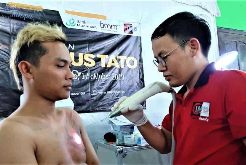 Kegiatan hapus tato yang dilaksanakan oleh Islamic Medical Service (IMS).
