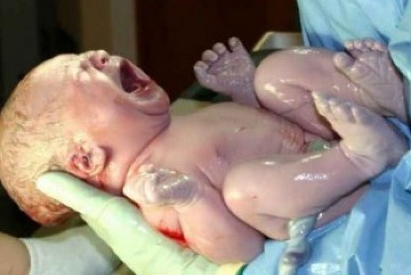  Kelahiran bayi manusia (ilustrasi)