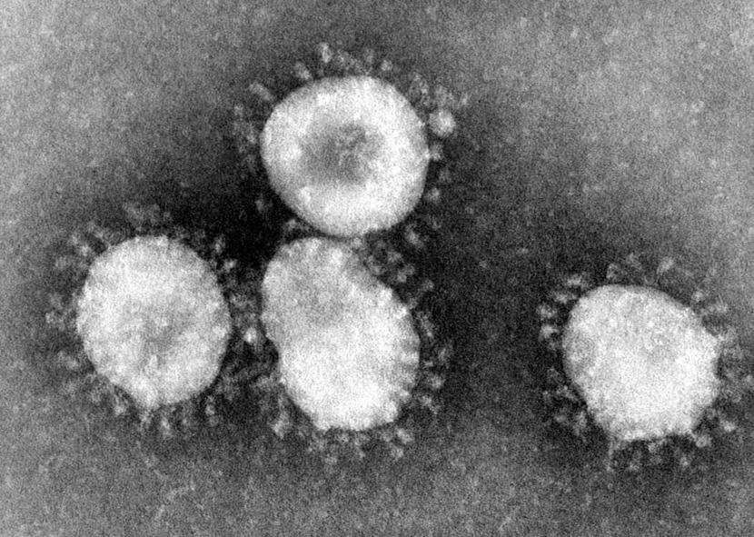 Keluarga virus corona dilihat melalui mikroskop elektron. 