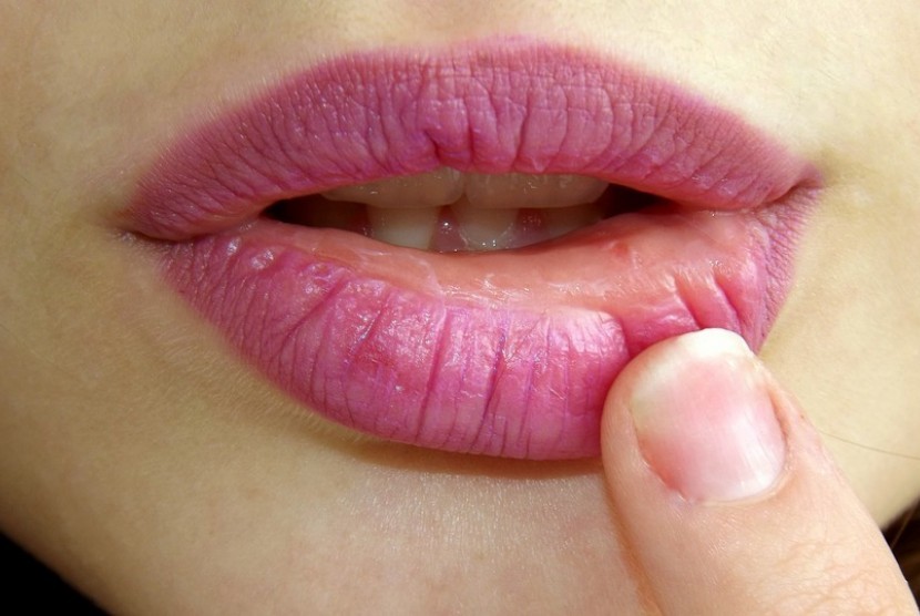 Kesehatan bibir perlu ditunjang dengan penggunaan pelembab bibir yang tepat.
