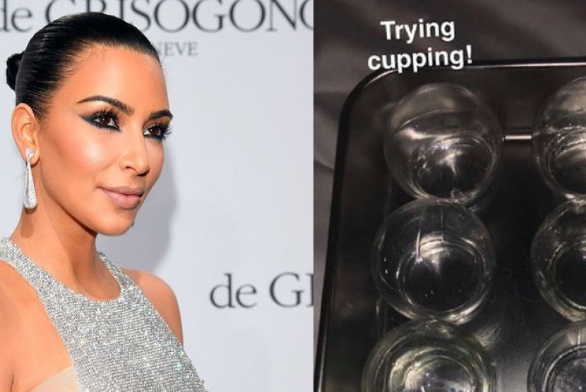 Kim Kardashian mencoba terapi bekam