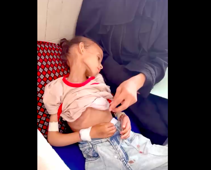 Kondisi anak-anak Gaza di RS Al Shifa, Gaza.