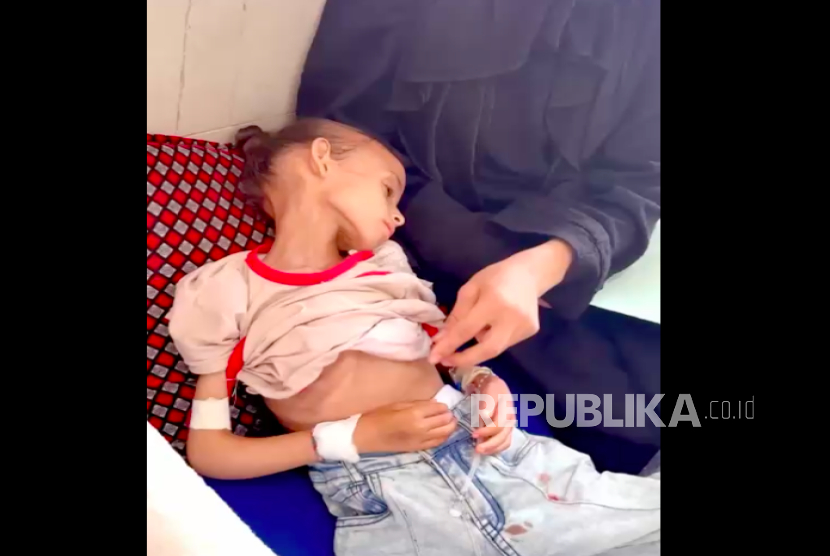 Kondisi pasien anak di RS Al Shifa di Gaza