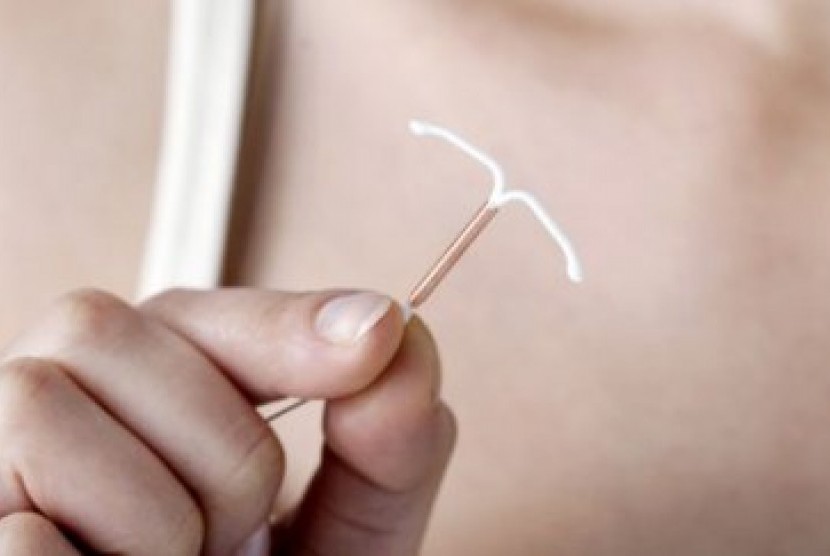 Dokter melarang wanita mencabut sendiri IUD (ilustrasi).