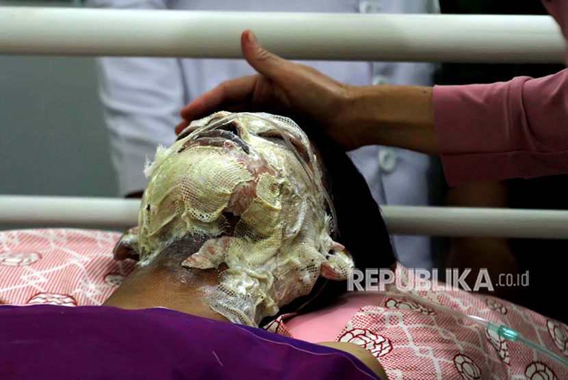 Korban ledakan sumur minyak ilegal dirawat di Rumah Sakit Umum Daerah (RSUD) dr Zubir Mahmud, Aceh Timur, Aceh, Rabu (25/4).