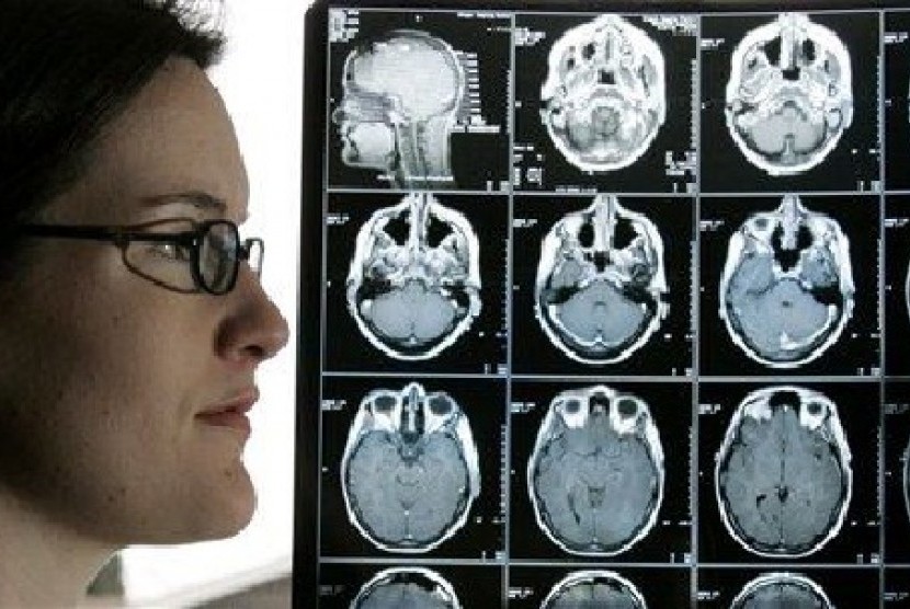 Kyla Nagel yang didiagnosis menderita kanker otak yang agresif, berdiri di sebelah hasil pemindaian otaknya.