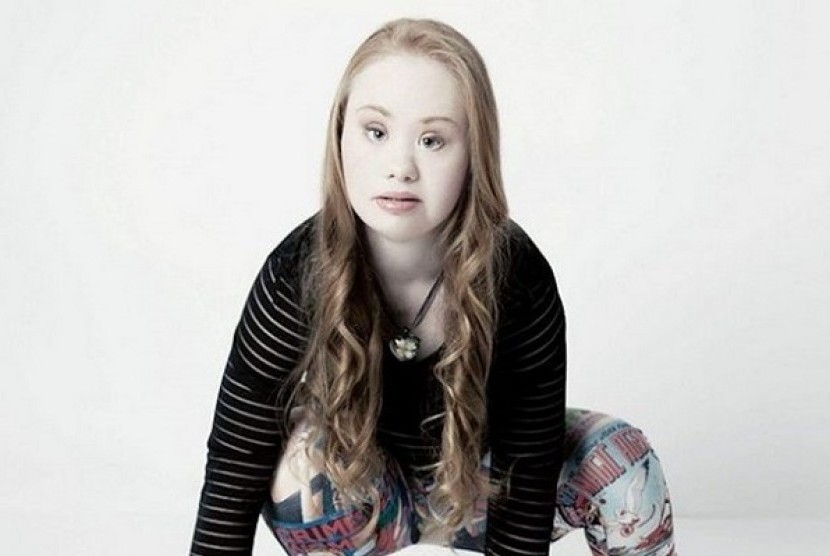 Hebat Gadis Penderita Down Syndrome Ini Jadi Model Republika Online 