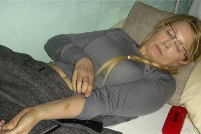  Mantan Perdana Menteri Ukraina, Yulia Tymoshenko, memperlihatkan lengannya yang mengalami luka akibat mendapat perlakuan buruk di penjara Kachanivska di Kharkiv.