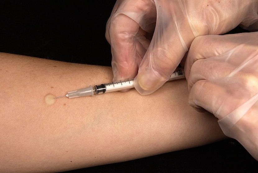 Mantoux tuberculin skin test is a test to detect TB infection. (illustration)