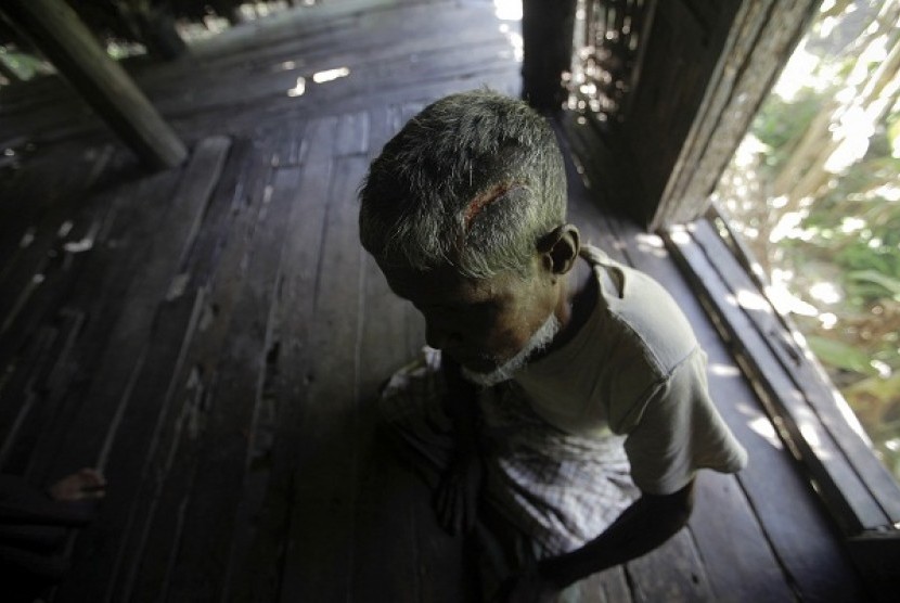 Muhammad Amin (62 years) a Muslim man who was beaten with a metal pipe until his skull cracked, sits in his home in Paik Thay, the site of recent violence between Muslim Rohingyas and Buddhist Rakhine people, November 2, 2012. Picture taken November 2.   