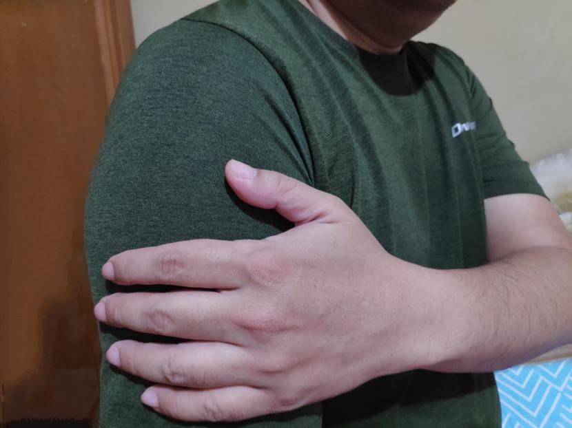 Pria memegang lengannya (Ilustrasi). Timbunan lemak di otot juga berbahaya bagi kesehatan.