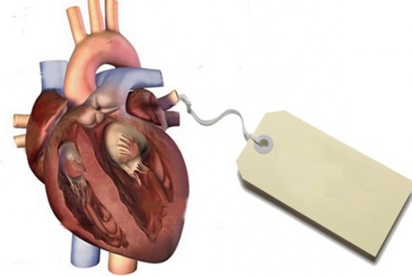 Organ manusia dibanderol dan diperdagangkan (ilustrasi)