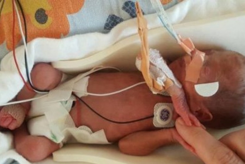 Orly dilahirkan prematur 15 minggu dan menghabiskan 107 hari kehidupannya di rumah sakit.