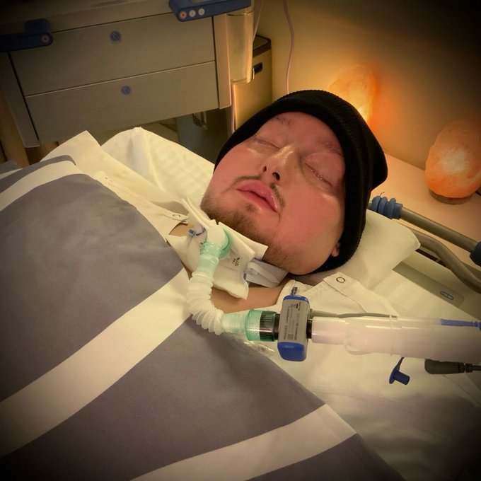 Pangeran Al-Waleed bin Khaled bin Talal Al Saud. Pangeran yang dikenal luas sebagai Pangeran Tidur di Arab Saudi dan dunia Arab, meninggal dunia pada usia 35 tahun, Sabtu (19/7/2025). Sholat Jenazah Pangeran Al Waleed dilakukan Ahad (20/7/2025) setelah Sholat Ashar.