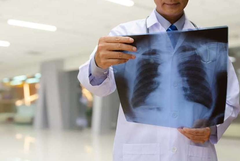 The worth of early detection of lung cancer due to undetected signs and symptoms