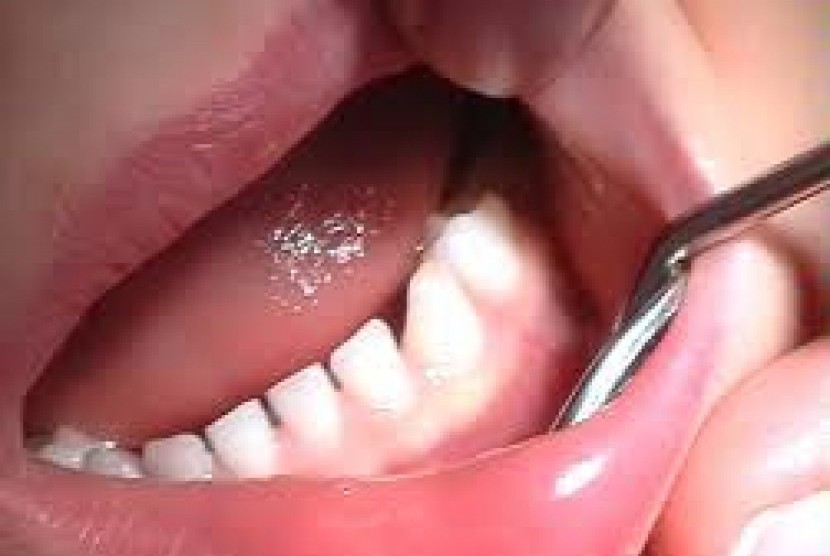 Ilustrasi dokter gigi. Banyak ahli kecantikan ilegal yang menawarkan layanan pemutihan gigi di Inggris.