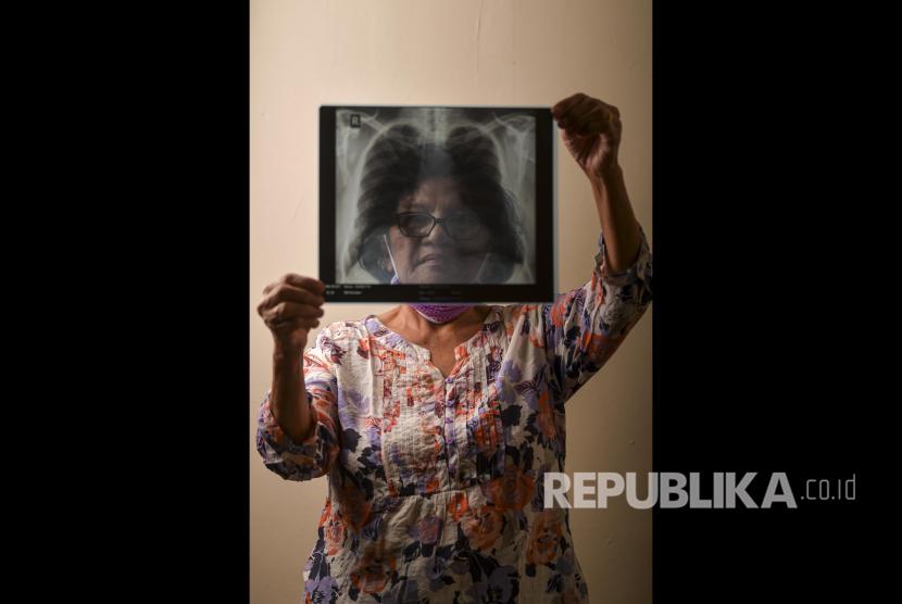 Warga menunjukkan hasil rontgen paru-paru miliknya di Jakarta. Peneliti pengungkap, sensasi tubuh tertentu adalah akibat dari kanker.