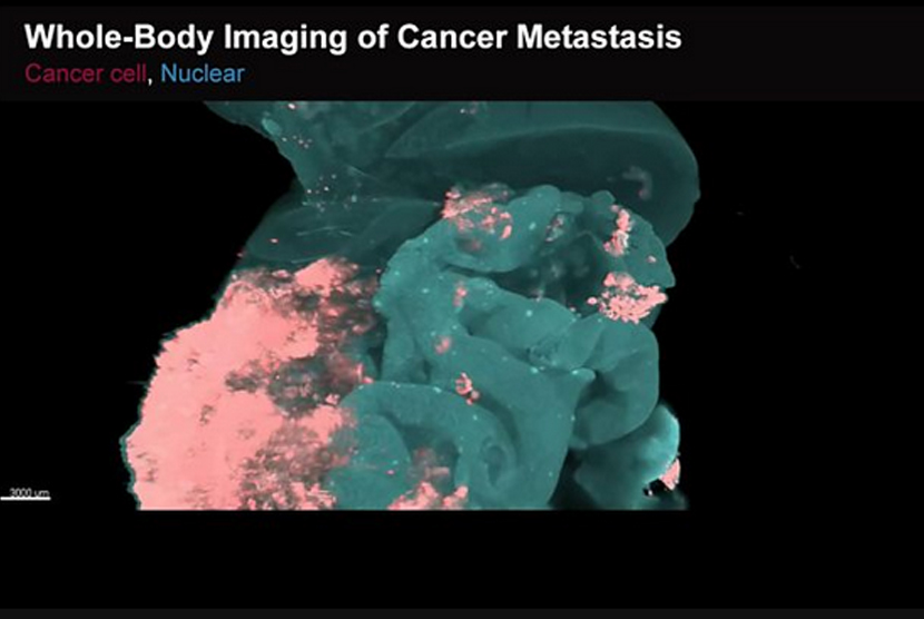 Peneliti Jepang tangkap proses penyebaran kanker menggunakan pencitraan 3D