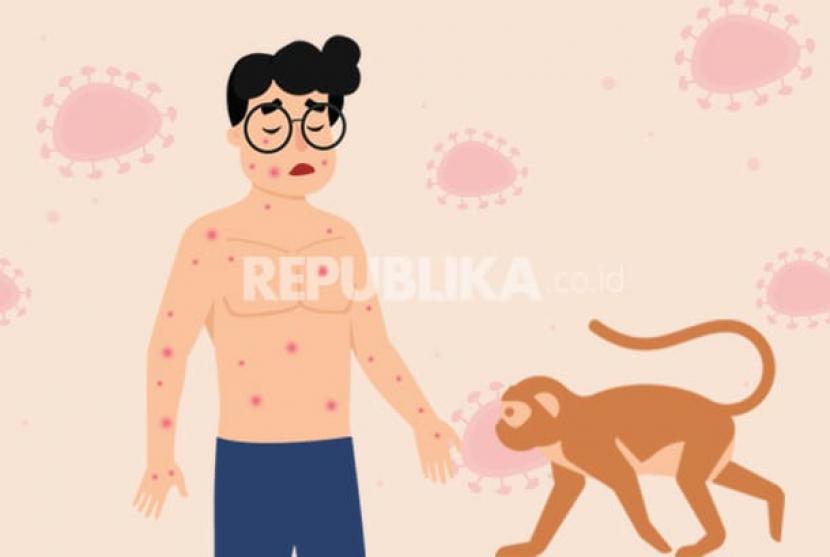 Cacar monyet (ilustrasi). Menurut Menkes, kasus cacar monyet atau Monkeypox di Indonesia tidak akan menular sepesat Covid-19.