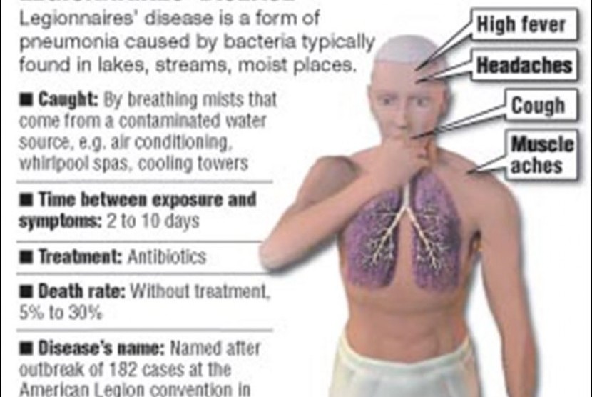 Penyakit Legionnaires. (ilustrasi)
