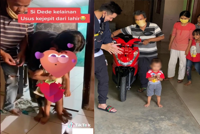 Perwakilan Astra Honda Motor dan Baim Wong sudah berkunjung ke kediaman Riyanto di kampung Grogol Limo, Depok, pada Rabu (9/9). Sebuah motor Honda Beat terlihat diserahkan kepada Riyanto, yang tentu butuh motor untuk mengantar anaknya berobat. 