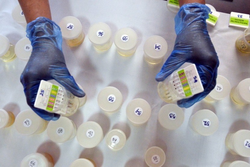 Arab Saudi Sita 14 Juta Pil Amfetamin. Foto: Petugas menujukkan sampel urine untuk diuji narkoba. (ilustrasi)
