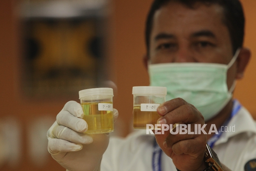 Petugas Badan Narkotika Nasional (BNN) menunjukkan sampel tes urine anggota DPR dari Fraksi PKS di Kompleks Parlemen, Senayan, Jakarta, Senin (29/2).  (Republika/Rakhmawaty La'lang)