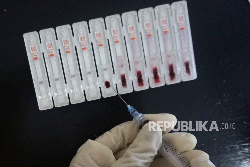 Petugas mengeluarkan sampel darah di atas perangkat rapid test HIV/AIDS 