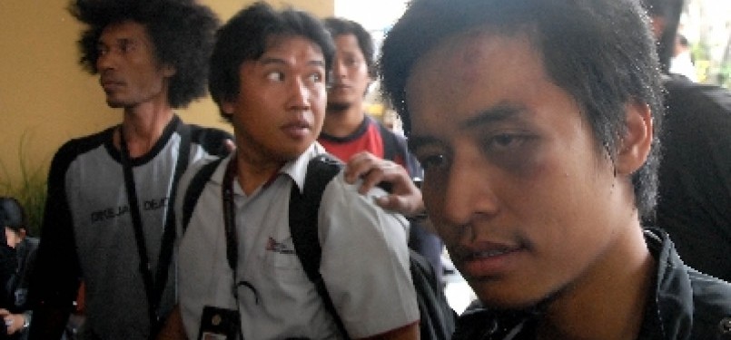 Pewarta foto Kompas.com, Banar Fil Hardhi, menjadi korban pengeroyokan siswa SMAN 6 terhadap wartawan di depan SMAN 6, Bulungan, Jakarta Selatan, Senin (19/9). 