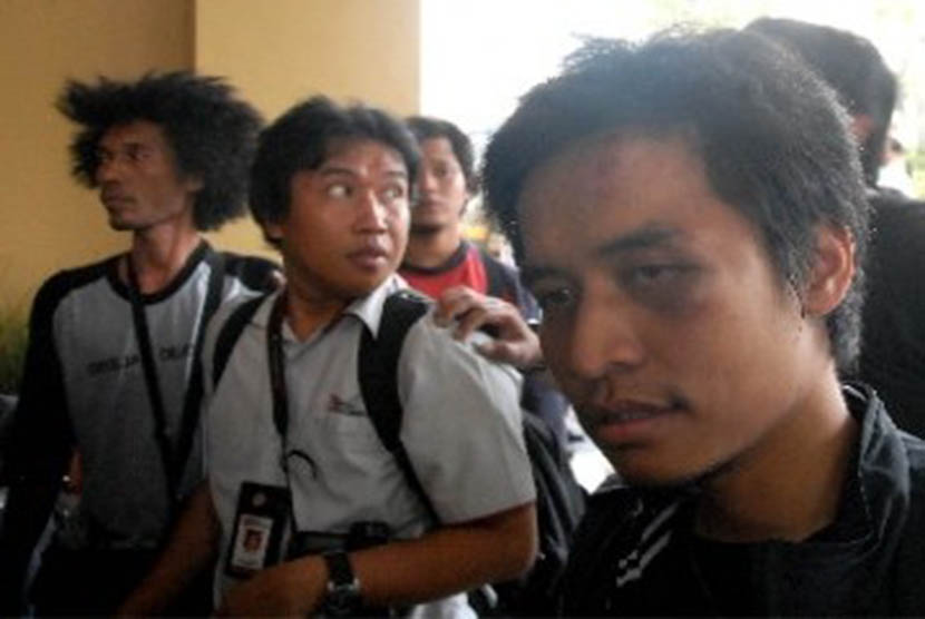 Pewarta foto Kompas.com, Banar Fil Hardhi, menjadi korban pengeroyokan siswa SMAN 6 terhadap wartawan di depan SMAN 6, Bulungan, Jakarta Selatan, Senin (19/9). 