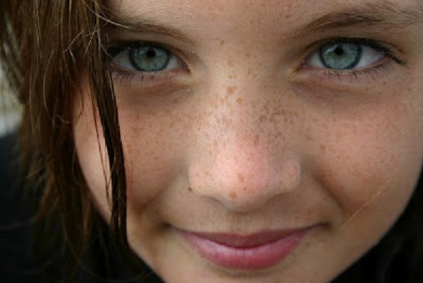Pigmentasi pada wajah perempuan (Ilustrasi)