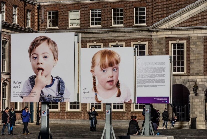 Poster memajang foto anak-anak penyandang sindroma down dalam rangka Hari Down Syndrome Seduni yang jatuh tiap 21 Maret.